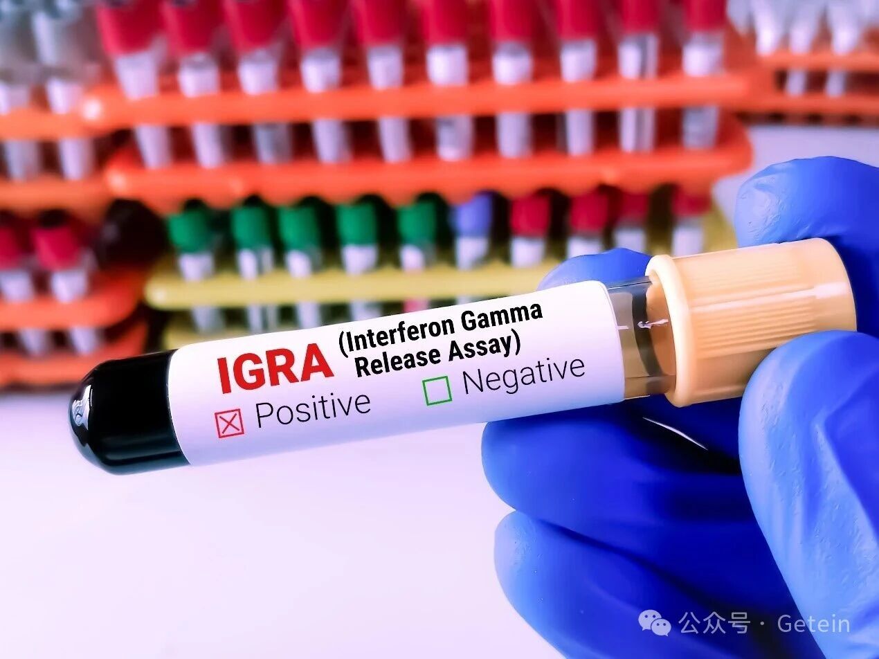 Solution complète et précise de test TB-IGRA